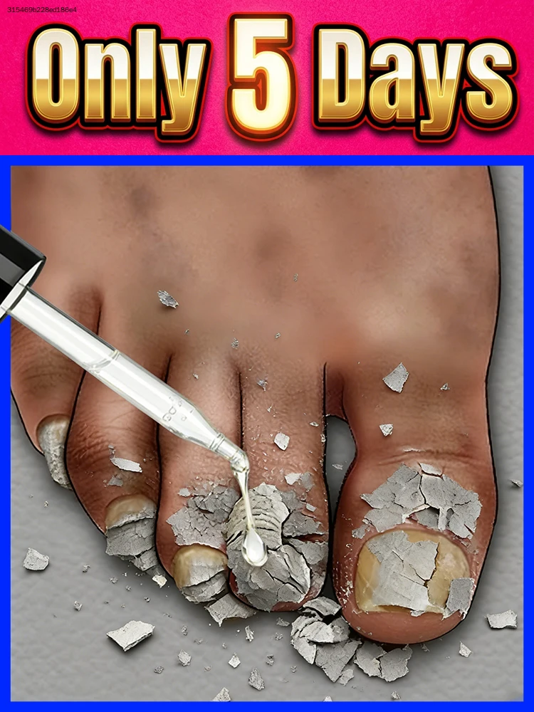 

Sᴀʏ ɢᴏᴏᴅʙʏᴇ ᴛᴏ ᴡᴇᴀᴋ ɴᴀɪʟs, sᴛʀᴇɴɢᴛʜᴇɴ ʟᴀʏᴇʀs ғᴏʀ ʟᴏɴɢ-ʟᴀsᴛɪɴɢ ᴠɪᴛᴀʟɪᴛʏ.