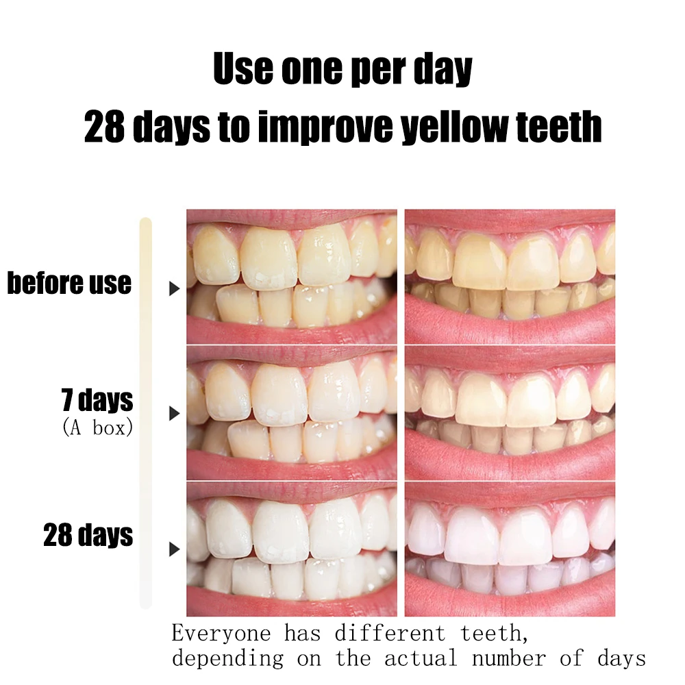 Sbiancamento dei denti essenza pulita igiene orale sbiancare i denti rimuovere le macchie di placca alito fresco igiene orale igiene orale set per la cura dei denti