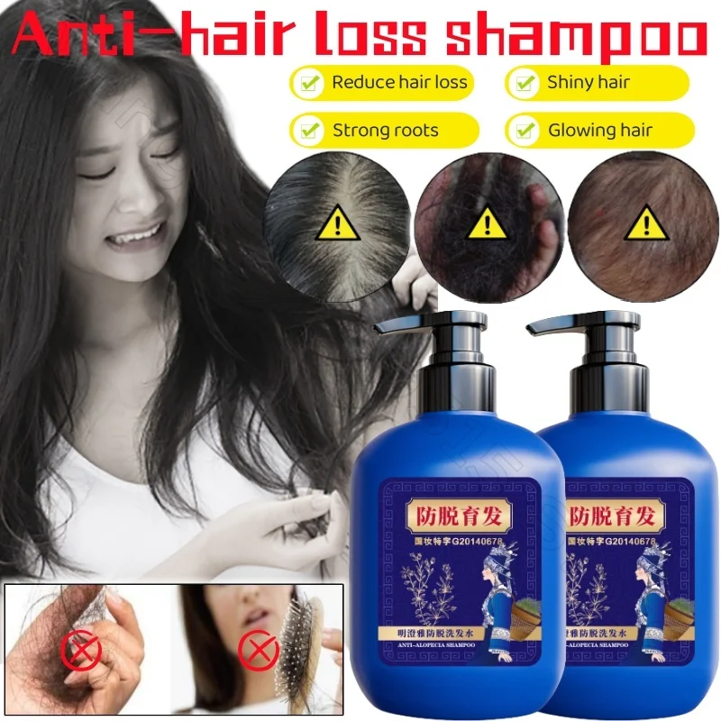 Miao Shampoo 300ml Effective Strengthening and Repairing Hair and Oil-controlling Scalp Ginger Plant-based Shampoo Water