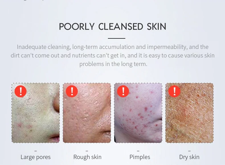 بالموجات فوق الصوتية تردد الراديو مكركرنتس تنظيف صغير العناية بالبشرة الجمال أجهزة شد الوجه الإلكترونية تدليك الوجه آلة الموجات فوق الصوتية #5