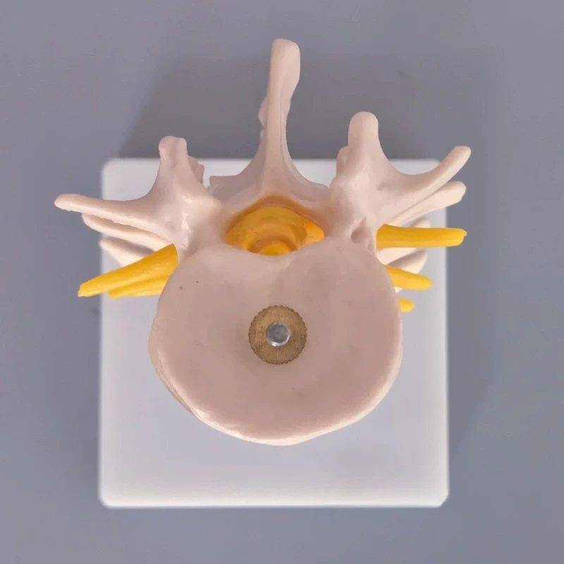 4-Segment Human Lumbar Spine Model with Intervertebral Discs and Nerves Orthopedic Anatomical Teaching Aid
