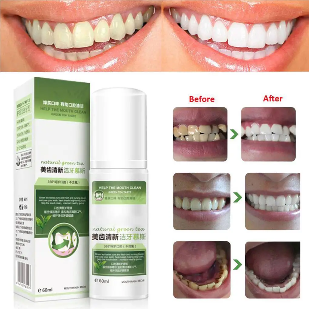 60ml Teeth Cleaning Mousse Fresh Breath Remove Tooth Stain Teeth Whitening Oral Cleaning Care