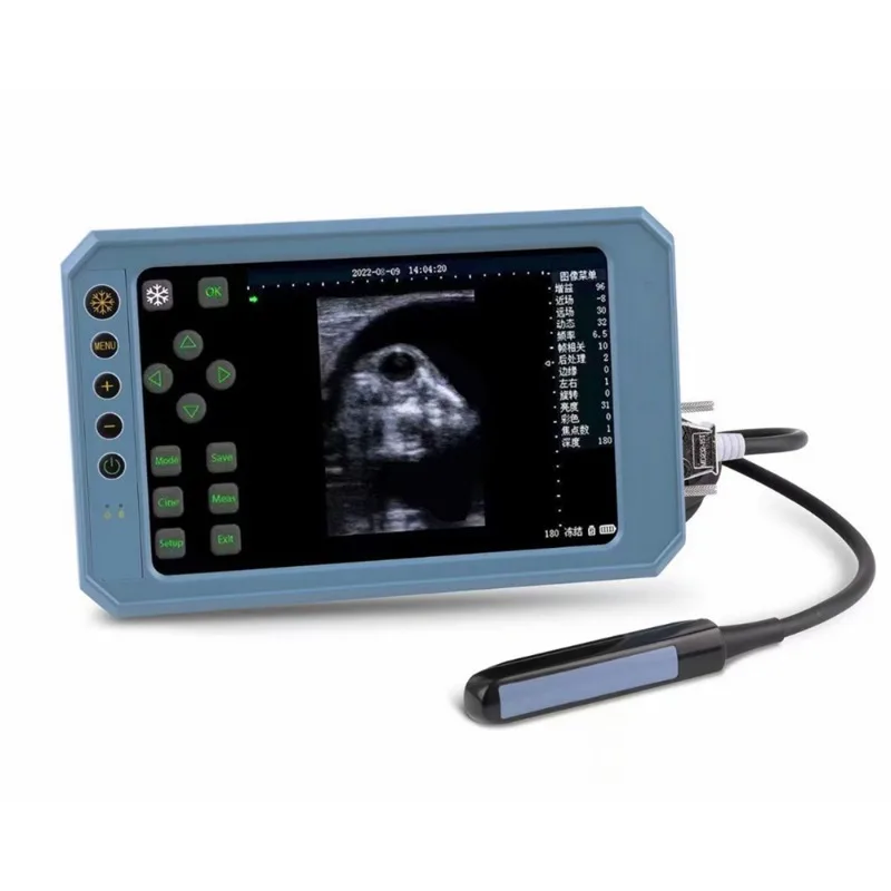 

7 Inch Full Large Touch Screen Handheld Veterinary Ultrasound Scanner With 6.5mhz Rectal Linear Probe 128 Elements
