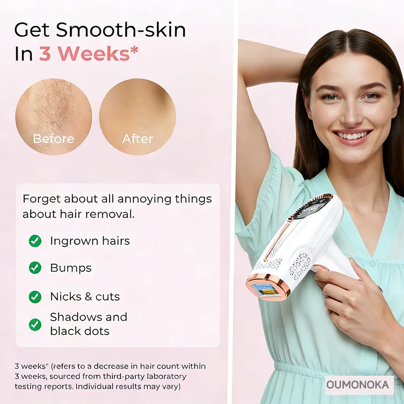 Thumbnail 3 - #52 Best IPL Devices to Buy In 2026