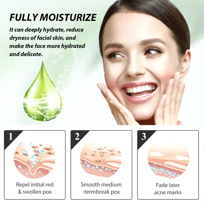 Herb Acne Removal Cream Treatment Pimple Scar Spots Shrink Pores Oil Control Whitening Moisturize Face Acne Skin Care