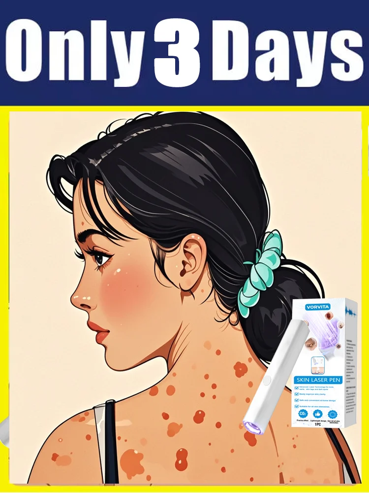 

2nd ᵍᵉⁿᵉʳᵃᵗⁱᵒⁿ ᵘᵖᵍʳᵃᵈᵉᵈ wᵃʳᵗ ⸴ ᑫᵘⁱᶜᵏˡʸ， ʳᵉpᵃⁱʳ wᵃʳᵗˢ ʳᵒoᵗ