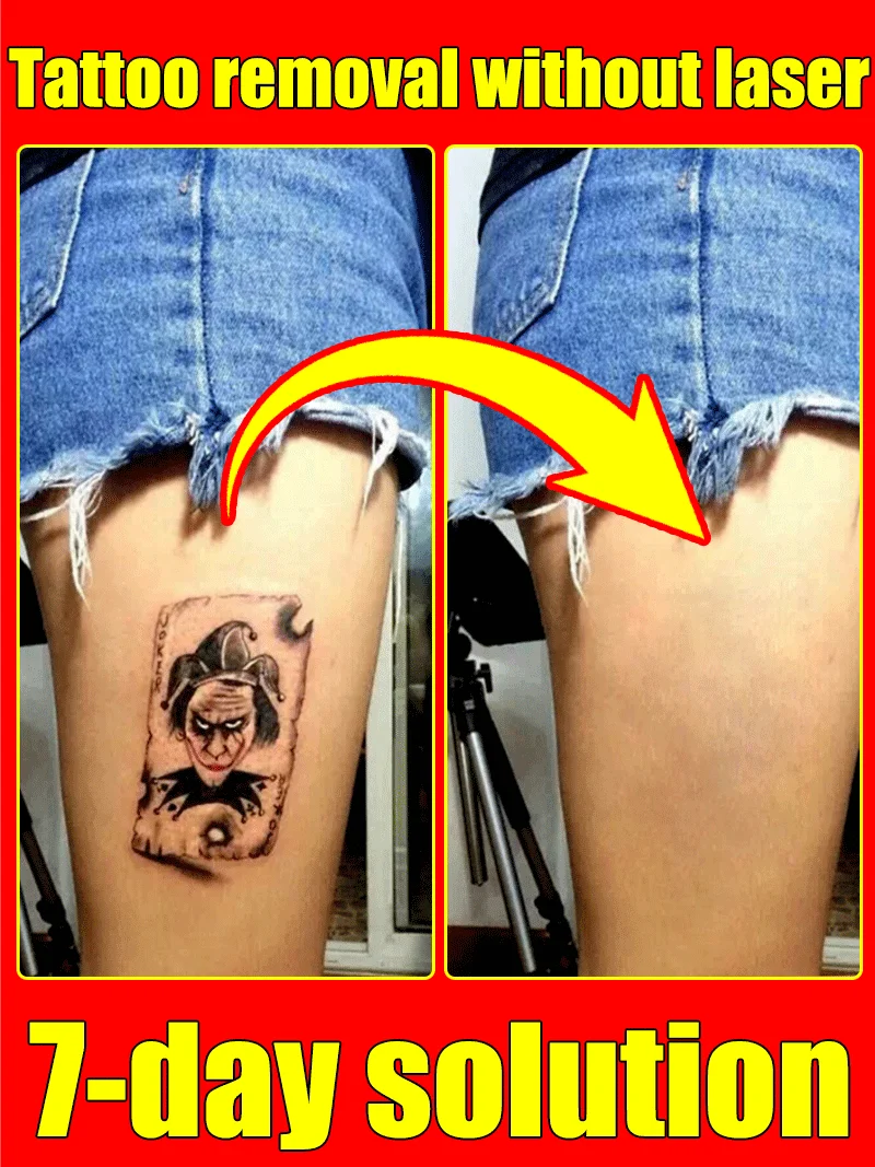 

Для удаления цветных перманентных татуировок, удаления татуировок с узорами.