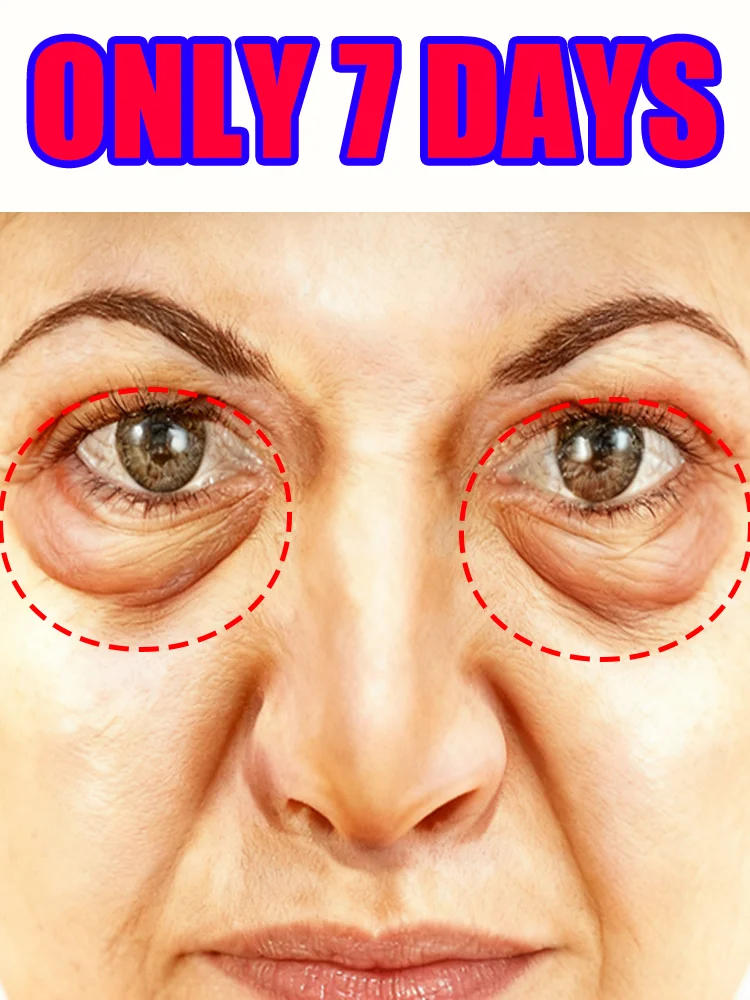 눈 관리 도구, 눈가방 전용으로 특별히 설계됨, 마사지는 다양한 문제를 해결합니다, 무료 배송