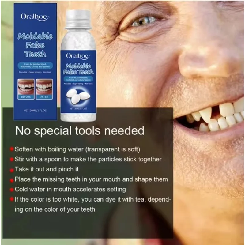 Temporary Tooth Repair Resin Solid Glue, Shapeable Material for Teeth Gaps, DIY Cosmetic Tooth Filling Supplies JJ3842