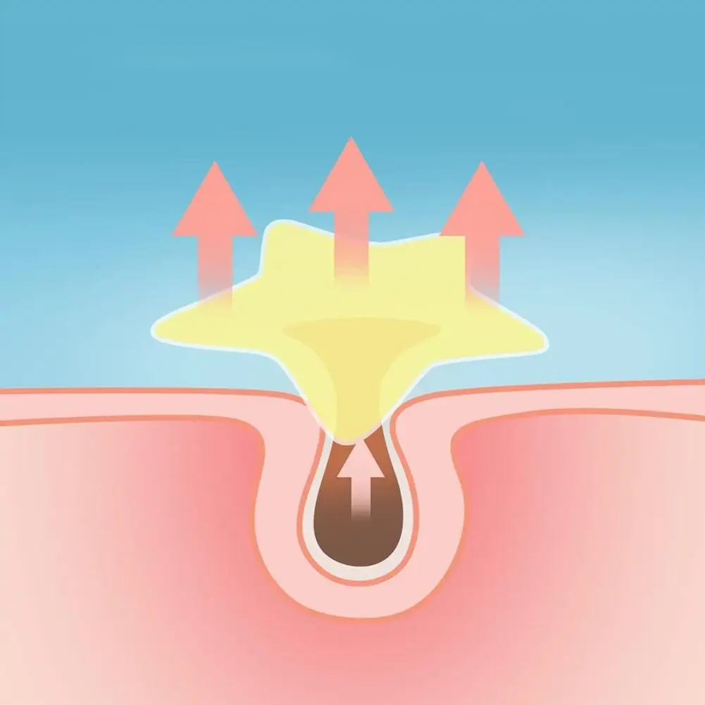 168 Plasterków na Pryszcze Plasterki na Trądzik w Kształcie Gwiazdek Nawilżające do Zakrywania Pryszczy i Niedoskonałości