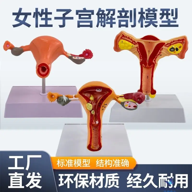 

Обучающая модель анатомии матки и яичника человека, женская внутренняя репродуктивная анатомическая модель, гинекологический тренировочный чай