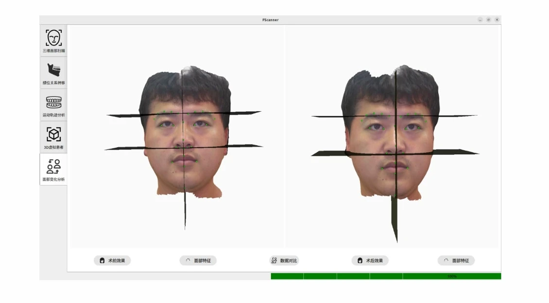 ماسح ضوئي للوجه عالي الدقة سريع السرعة مع ماسح ضوئي للوجه ثلاثي الأبعاد لطب الأسنان ذو ملمس ملون #5