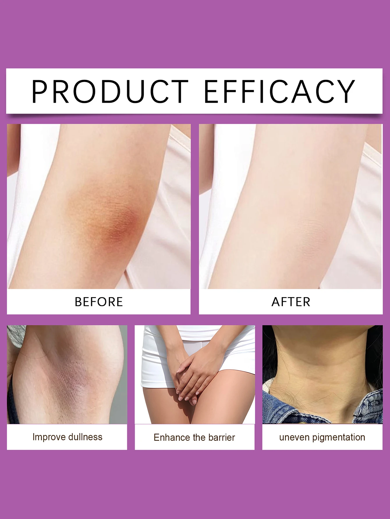 كريم تبييض الجسم 50 جرام، تبييض الأجزاء الخاصة للإناث، العناية المنعشة، الرعاية اليومية، كريم تبييض تحت الإبط