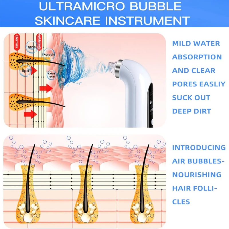 جديد وصول 2025 حار بيع فقاعة صغيرة مزيل الرؤوس السوداء نظافة دورة المياه البثرة الكهربائية فراغ مزيل الرؤوس السوداء #6
