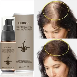 Fast Hair Growth Spray Products Anti Hair Loss Serum Prevent Baldness Treatment Scalp Dry Damaged Essential Oil Hair Beauty