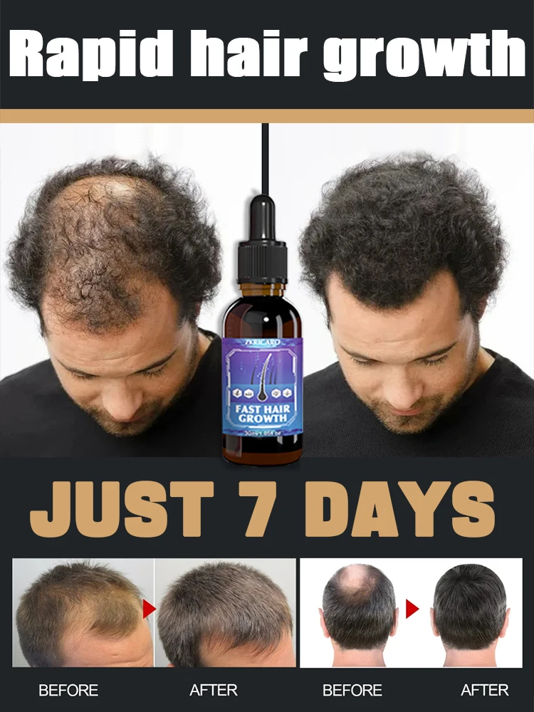 

98% of buyers buy again, have more and more hair, say goodbye to baldness, thick hair,Hot selling product.