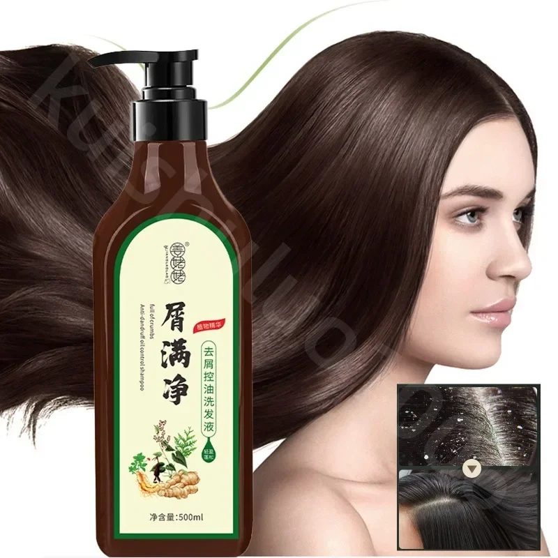 

Pure Natural Plant Anti-dandruff Black Shampoo To Remove Mites and Itching Folliculitis Clean Scalp Anti-hair Loss Hair Care