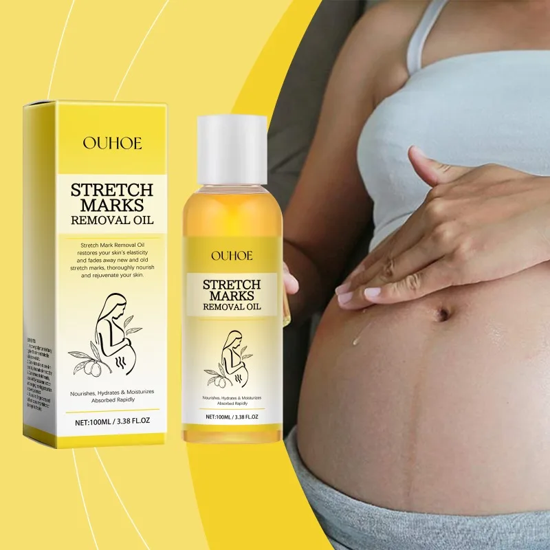 Stretch Mark Removal Oil Repairing หลังคลอด Moisturizing Firming Body ปรับปรุงผิวคลอดบุตร Skin Application Care น้ํามัน