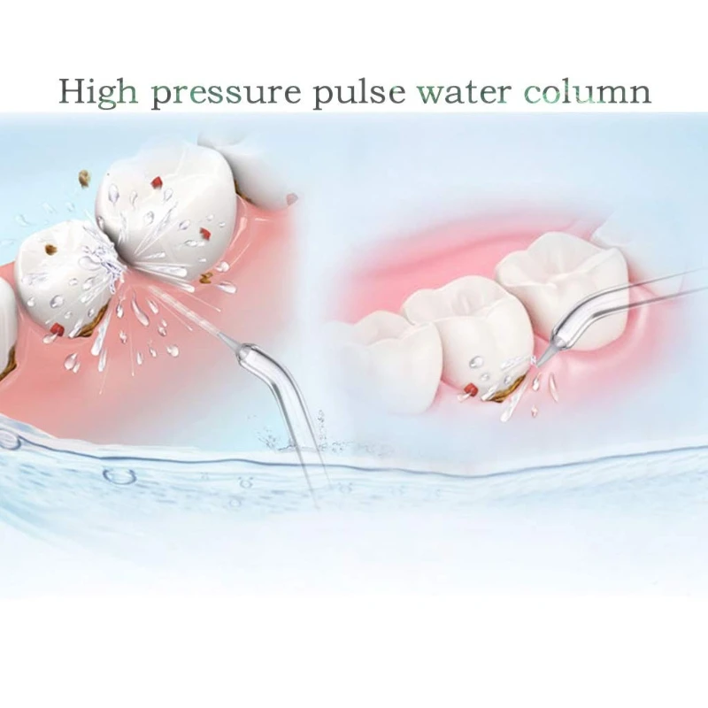 نصائح استبدال دودة الحرير المياه ، رؤساء الملء ل Waterpik وغيرها من الري العلامة التجارية ، وسهلة الاستخدام