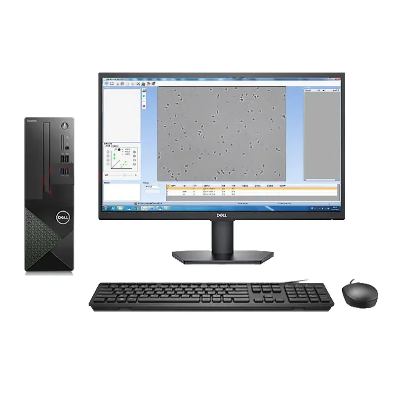 RCW ICEN Medical Equipment Automatic Lab Sperm Quality Analyzer /semen Analyzer Price/sperm Analysis Machine