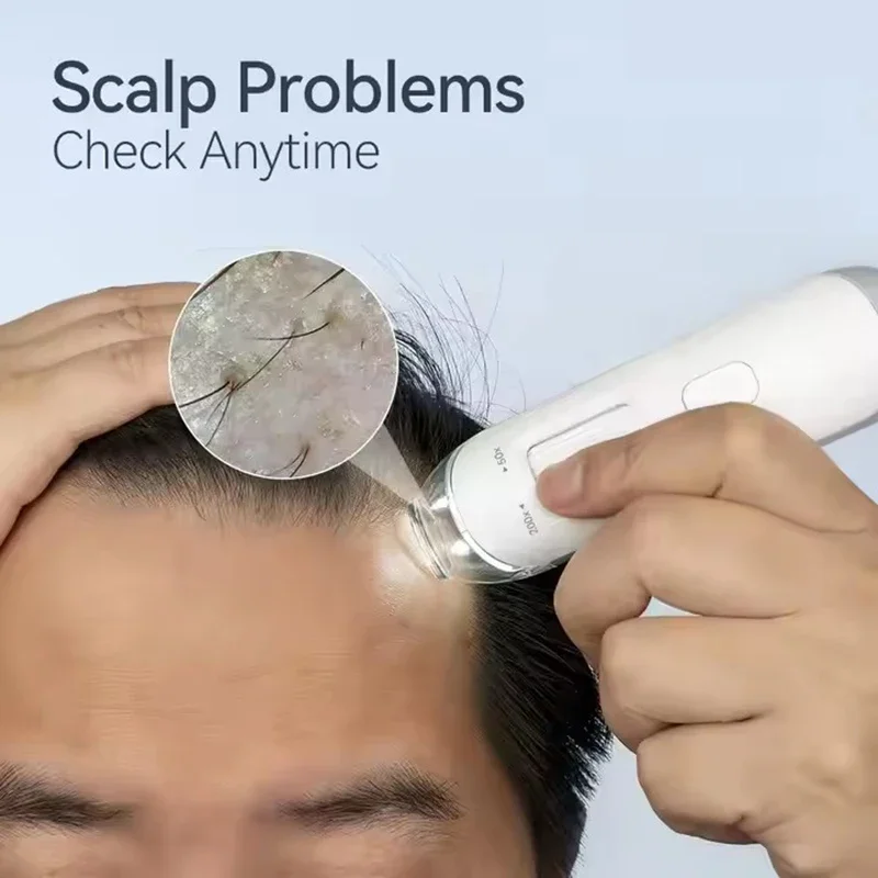 50X/200X HD Android Telefon Display Haar Analysator Heimgebrauch Kopfhaut Haarfollikel Scanner Detektor USB Verbindung Haut Kopfhaut Analyse