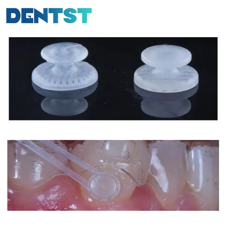 Dentst 10pcs Dental Orthodontics Lingual Buttons Clear Ceramic Composite Round Rectangular Point Ligadura Ortodoncia