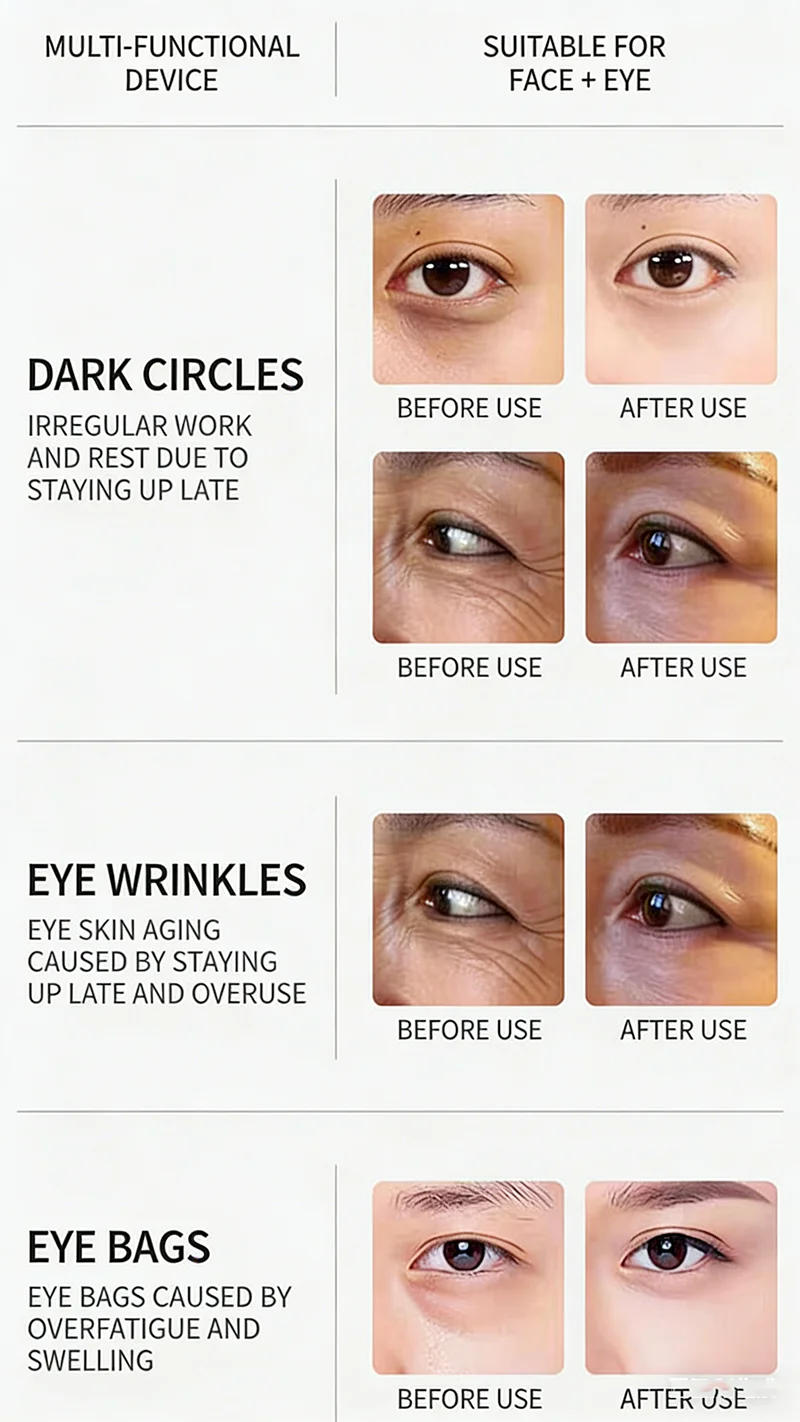 أربعة أجيال من جهاز التجميل الماجستير للعين والوجه لصالونات التجميل لشد والقضاء على الهالات السوداء للوجه #4