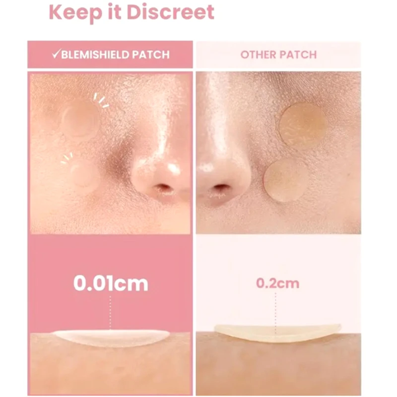 360 Pieces Of Heart Star Face Skin - Care Acne Pimple Patches For Invisible And Professional Healing