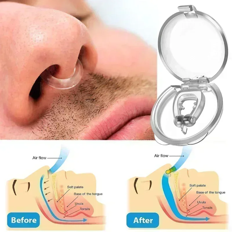 1/2PcsSilicone Magnetic Anti Snore Stop Snoring Nose Clip Sleep Tray Sleeping Aid Apnea Guard Night Device with Case Anti Tools