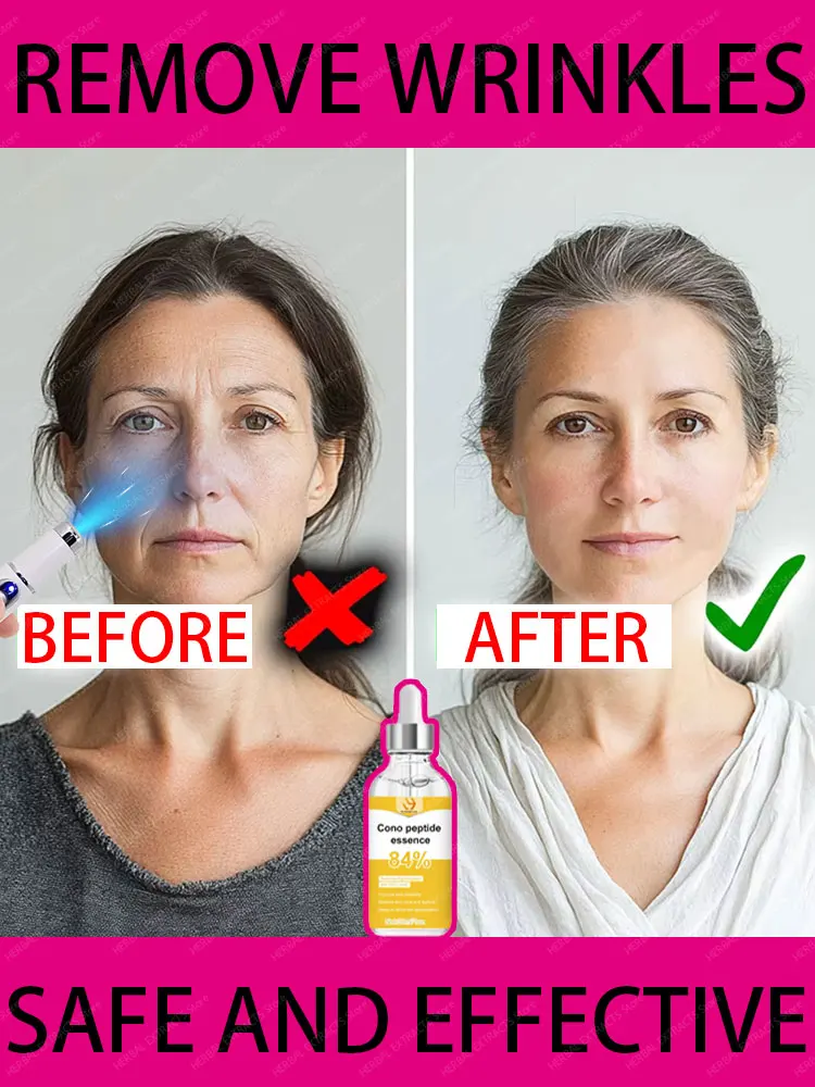 

A Facial firming elevator Korean cosmetics