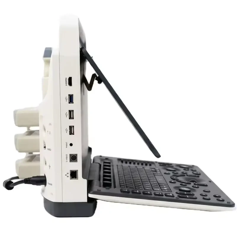 Electric Portable 3D 5D Machine Echograph System High Resolution LCD Accessories