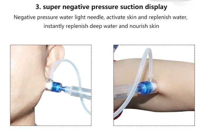 Mesogun SamsungDuction、非接続性メソセラピー