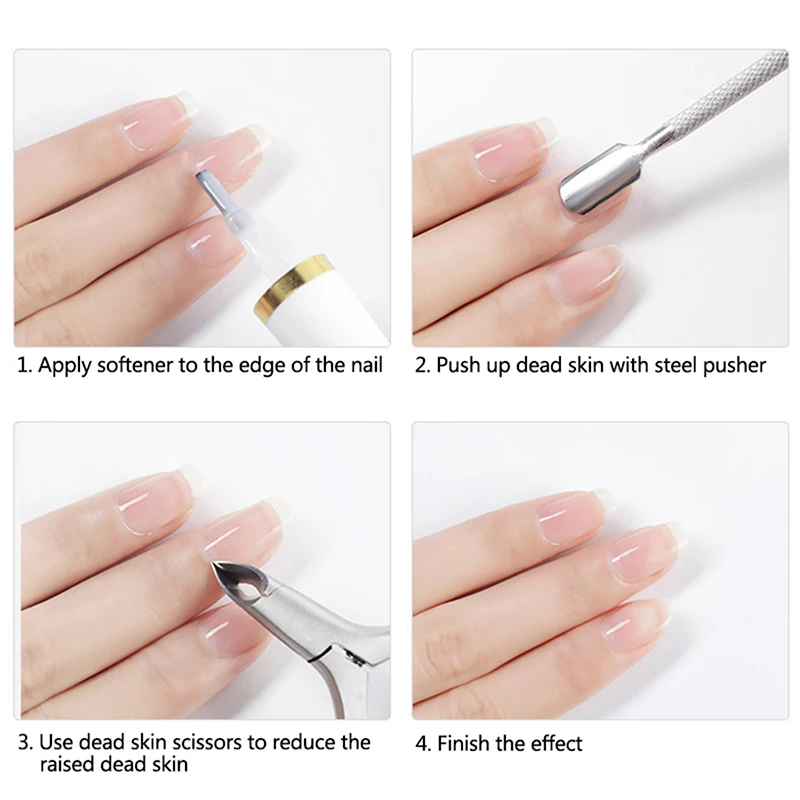 15Ml Nagelriem Verwijderaar Gel Crème Nagelhuidverzachter Professionele Nagel Levert Manicure Hulpmiddelen Voor Vingernagels En Teennagels