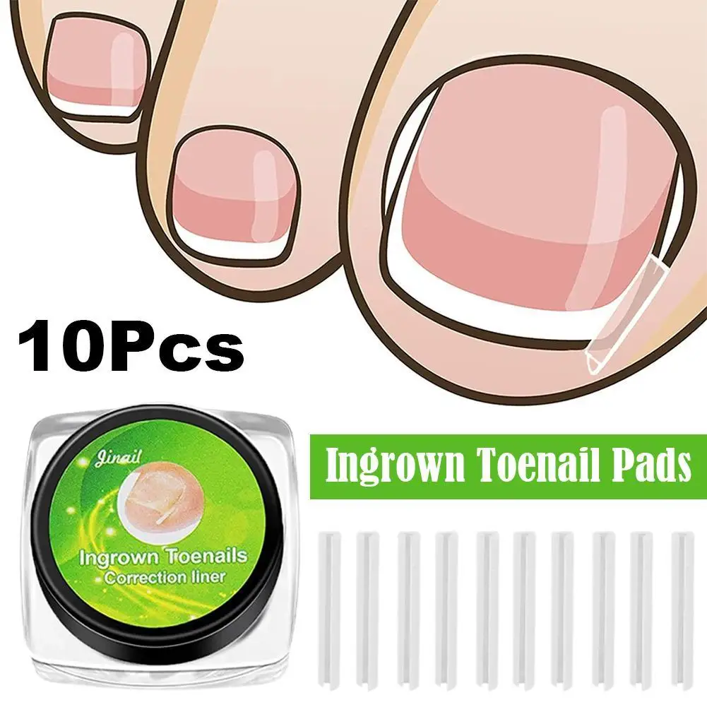 10-шт-наклейки-для-коррекции-ногтей-корректор-вросшего-ногтя-патчи-для-лечения-паронихии-корректор-для-восстановления-инструменты-для-педикюра