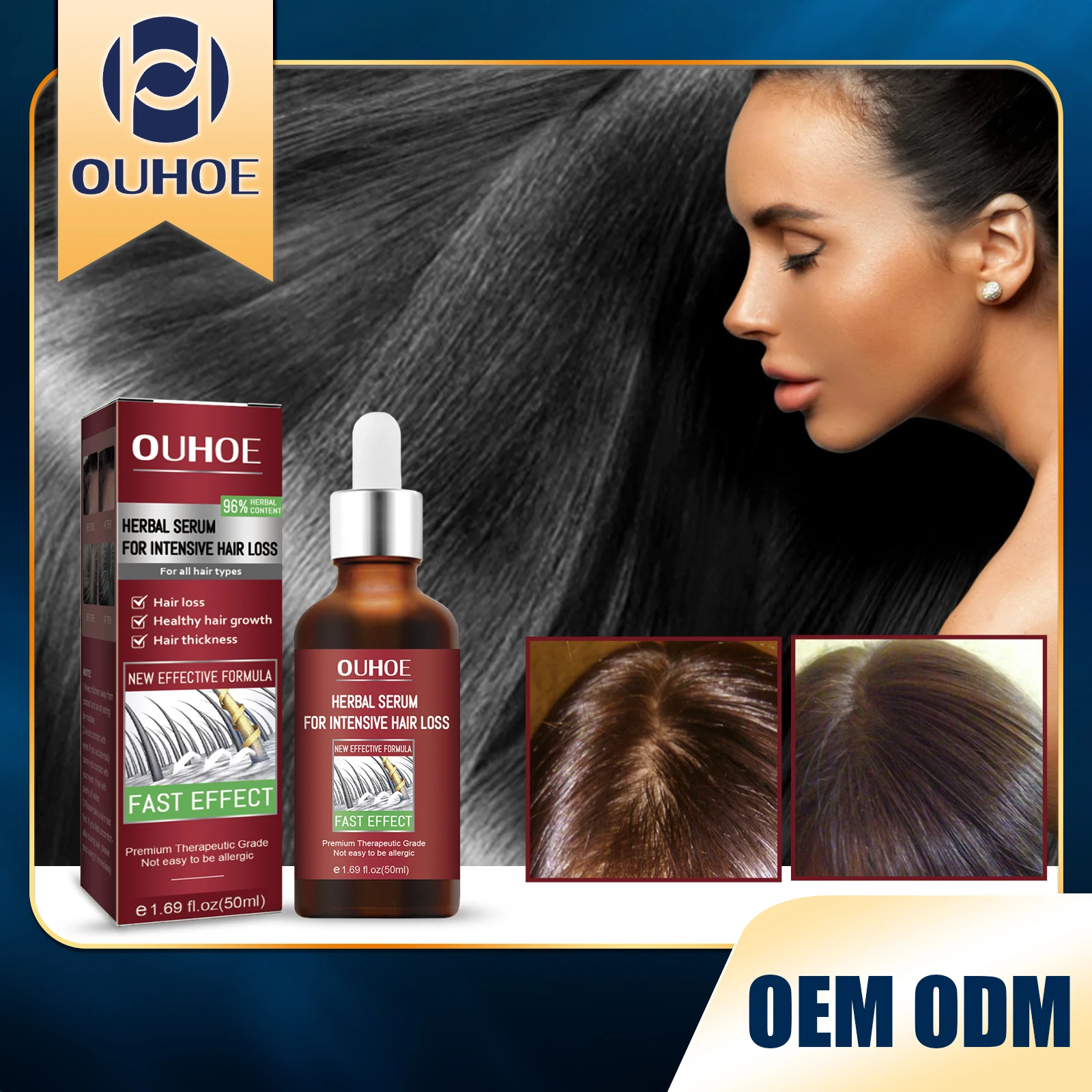 OUHOE Hair Restoration Serum Nourishing Scalp Hair Growing Firming Root Repair Dry Damaged Moisturizing Hair Regrowth Oil 50ML