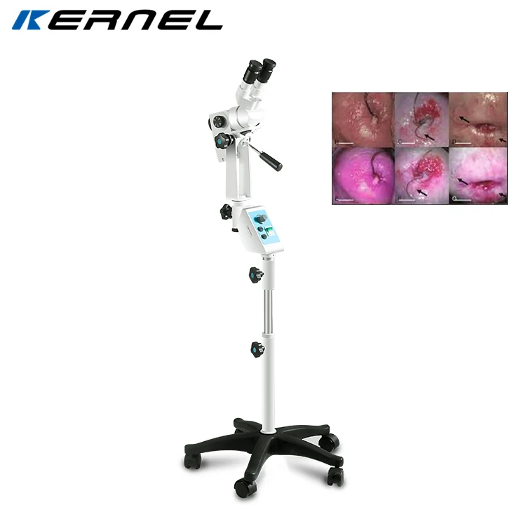 Professional Optical Colposcope Binocular medical video colposcope for Gynecology Examination