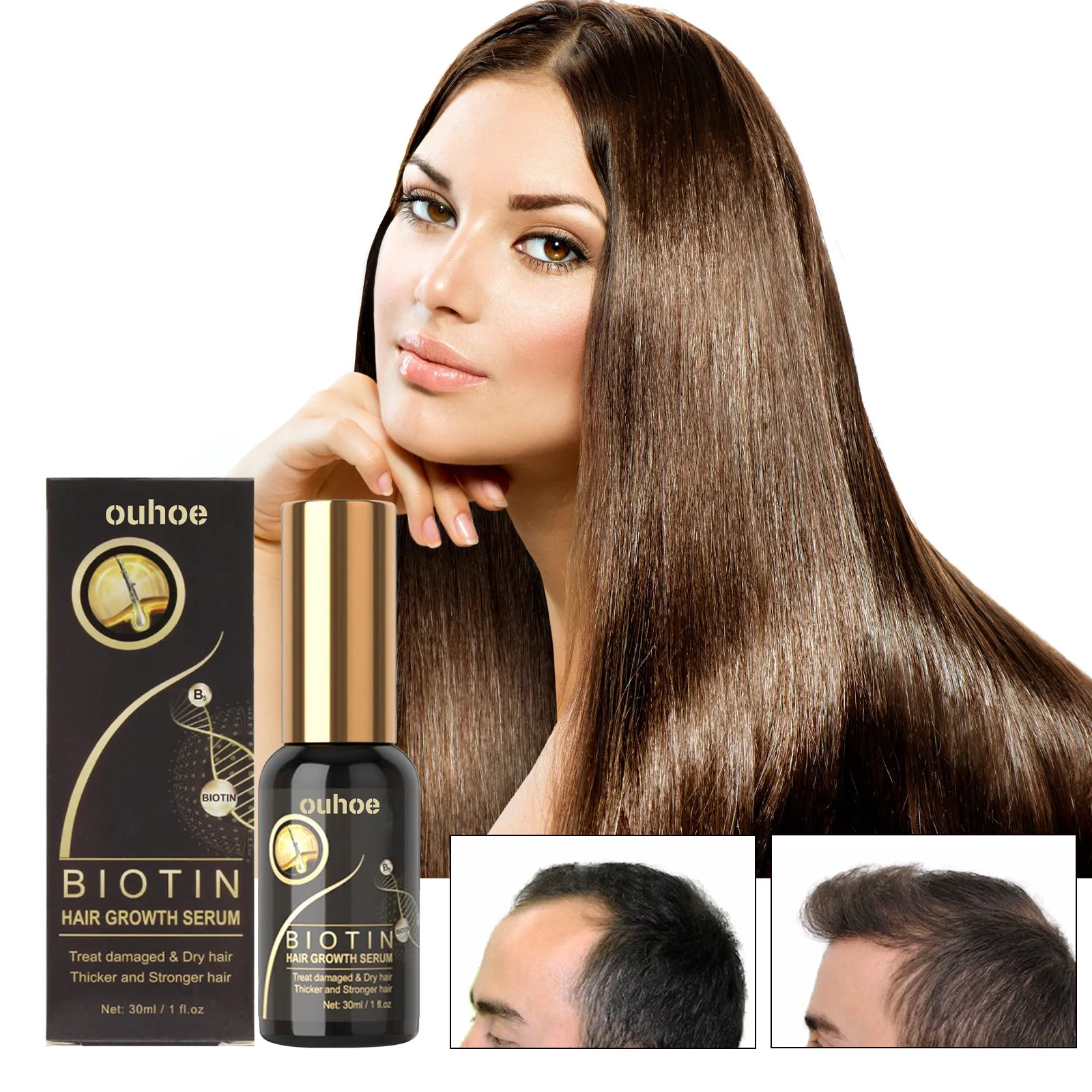 BIOTIN Essence Hair Growth Pump-Serum Repairing hairline nourishing hair root thick hair strong and firm hair essence products