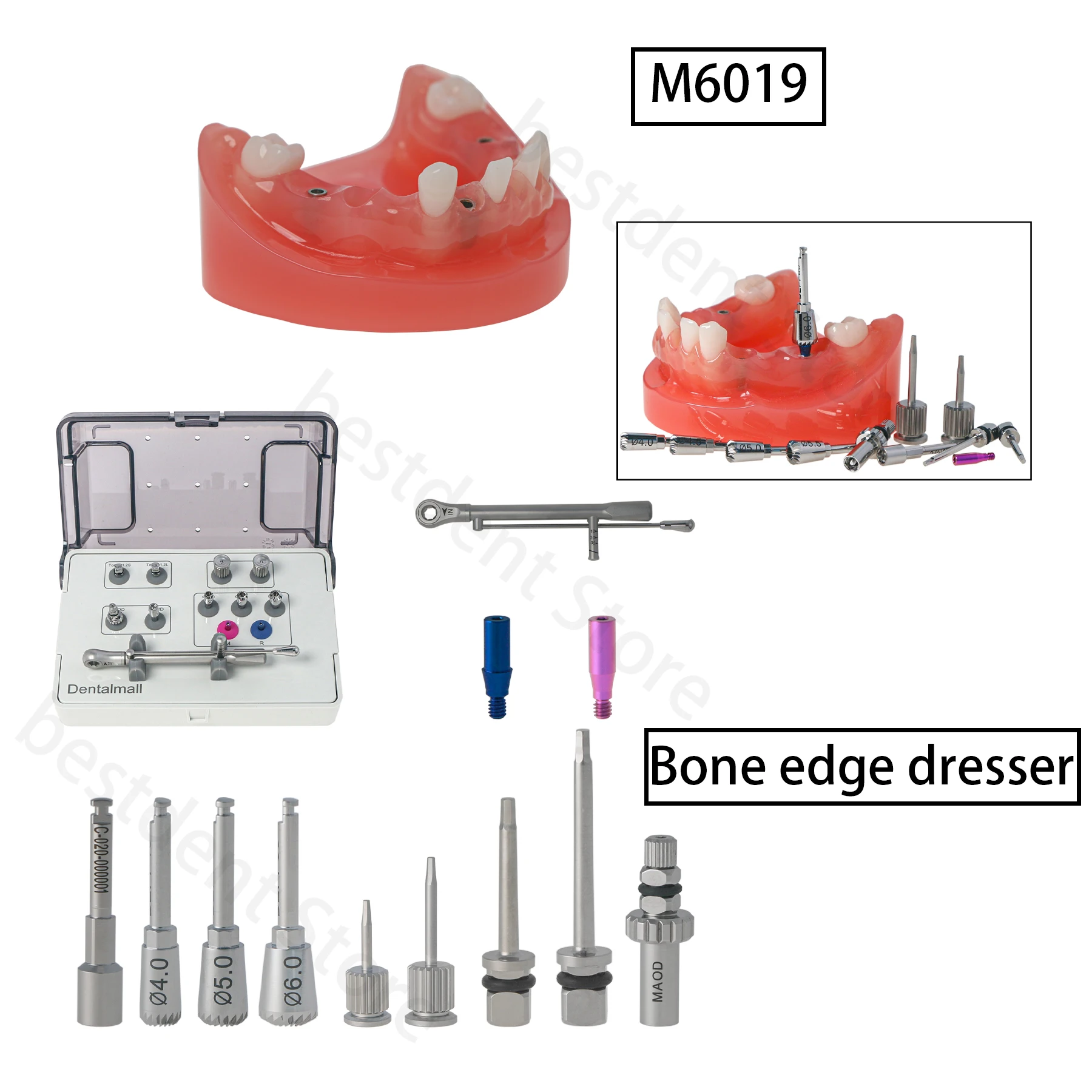 Dental HIOSSEN Osster Bone Edge Abutment Implant Drivers Screwdriver&Teeth Model