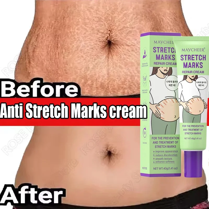 ΠΡΠ΅ΠΌ Π΄Π»Ρ ΠΏΠ΅ΡΠΌΠ°Π½Π΅Π½ΡΠ½ΠΎΠ³ΠΎ ΡΠ΄Π°Π»Π΅Π½ΠΈΡ ΡΠ°ΡΡΡΠΆΠ΅ΠΊ, Π±Π΅ΡΠ΅ΠΌΠ΅Π½Π½ΡΡ
ΠΆΠ΅Π½ΡΠΈΠ½, Π±Π΅ΡΠ΅ΠΌΠ΅Π½Π½ΡΡ
, ΠΏΡΠΎΡΠΈΠ² ΠΌΠΎΡΡΠΈΠ½, Π³Π»Π°Π΄ΠΊΠΎΠ΅ Π²ΠΎΡΡΡΠ°Π½ΠΎΠ²Π»Π΅Π½ΠΈΠ΅, ΡΠΊΡΠ΅ΠΏΠ»ΡΡΡΠ°Ρ ΠΊΠΎΠΆΠ°, ΡΡ
ΠΎΠ΄ Π·Π° ΠΊΠΎΠΆΠ΅ΠΉ ΡΠ΅Π»Π° ΠΡΠ΅ΠΌ Π΄Π»Ρ ΠΏΠ΅ΡΠΌΠ°Π½Π΅Π½ΡΠ½ΠΎΠ³ΠΎ ΡΠ΄Π°Π»Π΅Π½ΠΈΡ ΡΠ°ΡΡΡΠΆΠ΅ΠΊ, Π±Π΅ΡΠ΅ΠΌΠ΅Π½Π½ΡΡ
ΠΆΠ΅Π½ΡΠΈΠ½, Π±Π΅ΡΠ΅ΠΌΠ΅Π½Π½ΡΡ
, ΠΏΡΠΎΡΠΈΠ² ΠΌΠΎΡΡΠΈΠ½, Π³Π»Π°Π΄ΠΊΠΎΠ΅ Π²ΠΎΡΡΡΠ°Π½ΠΎΠ²Π»Π΅Π½ΠΈΠ΅, ΡΠΊΡΠ΅ΠΏΠ»ΡΡΡΠ°Ρ ΠΊΠΎΠΆΠ°, ΡΡ
ΠΎΠ΄ Π·Π° ΠΊΠΎΠΆΠ΅ΠΉ ΡΠ΅Π»Π°