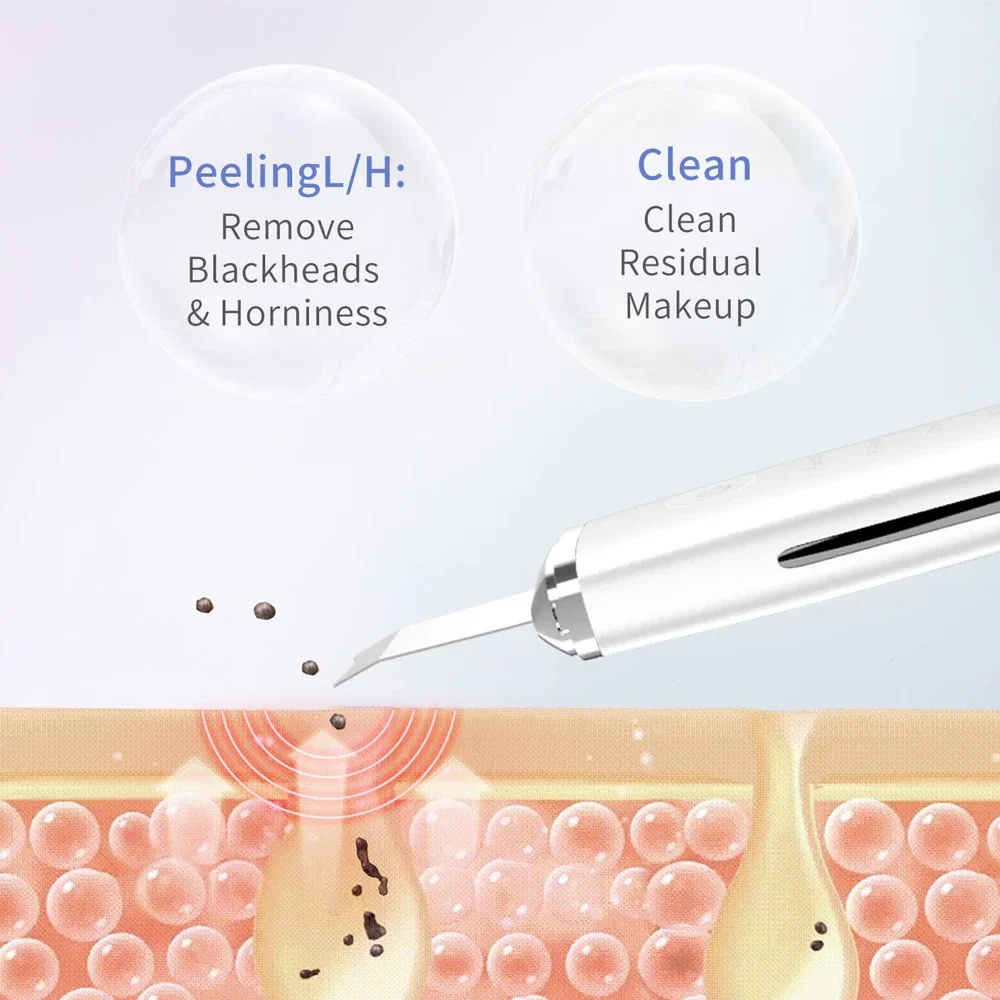 Skin Scrubber Peeling removedor de cravos, Limpeza Facial Profunda, Limpador De Poros De Acne, Limpador De Pá Facial