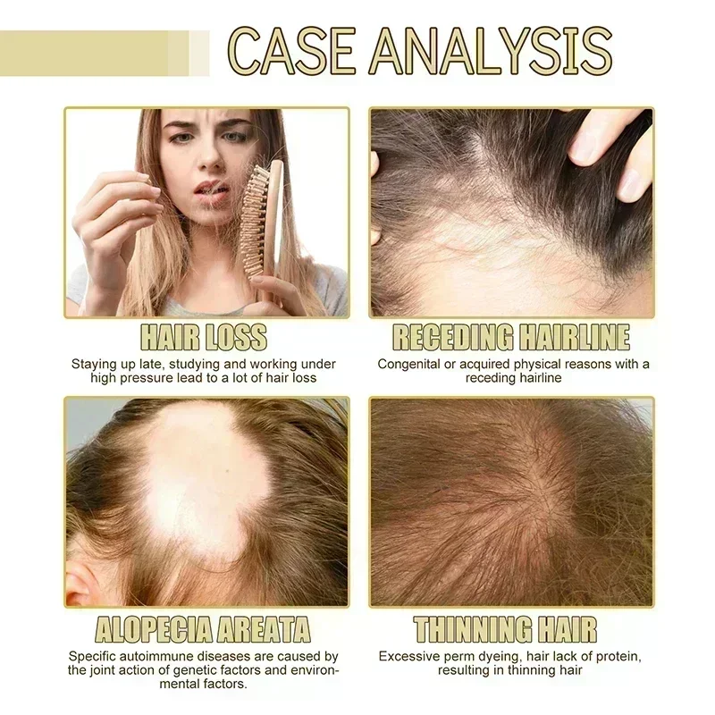 Suero rápido para el crecimiento del cabello, aceite para Barba axilar y pecho, líquido para el crecimiento del cabello más largo y grueso, previene la alopecia, anticaída del cabello