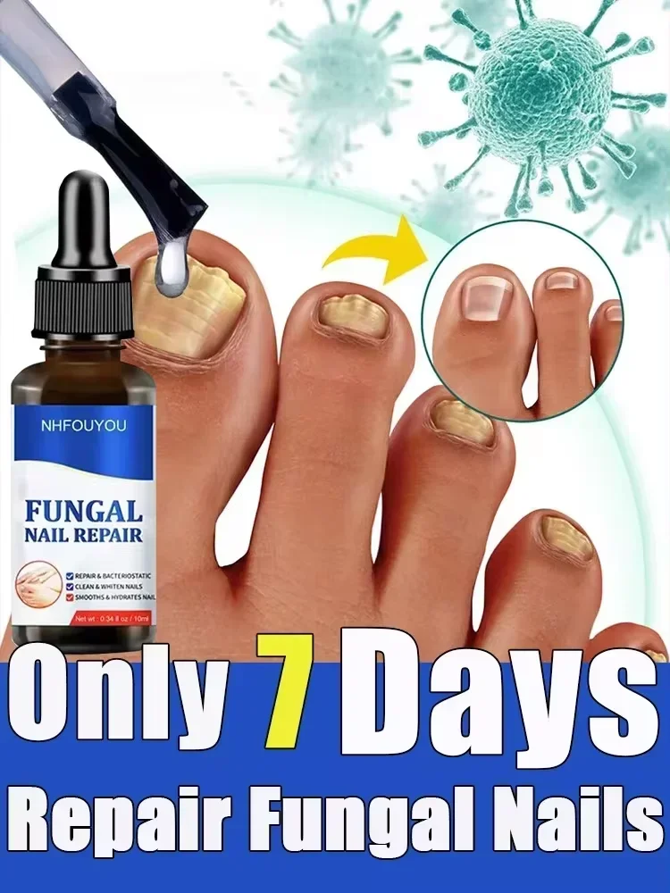 Toenail Nail Fungus Treatment Repair Fingernail Device Toenail Treatment for Foot Nail Fungus Essential Oil Onychomycosis Care