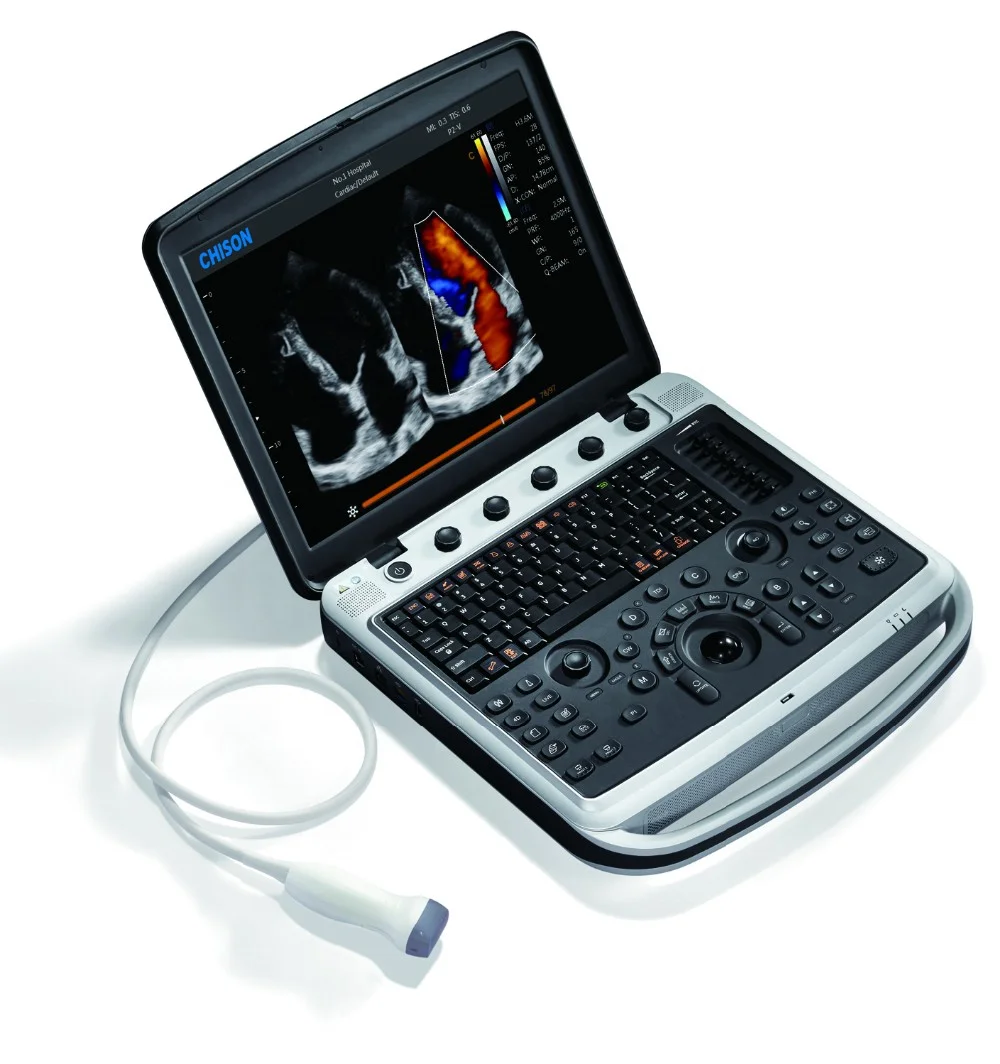 Medical Hospital Veterinary Equipment 4D Portable Color Ultrasound Scanner Veterinary Ultrasound Animal