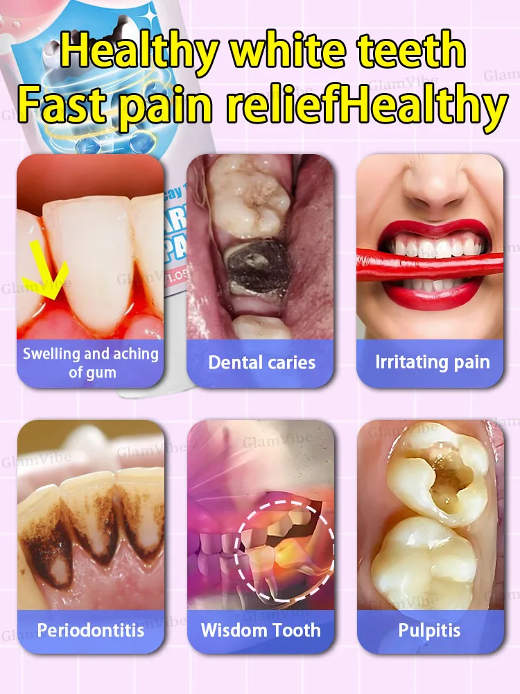 Riparazione della carie dentifricio trattamento cavità