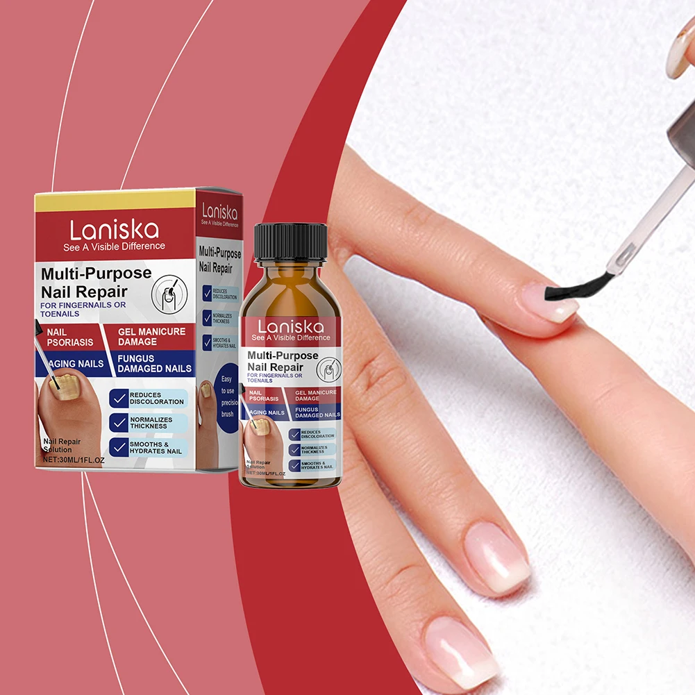 Nagellösung für Nägel mit verfärbten Schäden stellen die Verfärbungsdicke wieder her. Pflege in Salonqualität