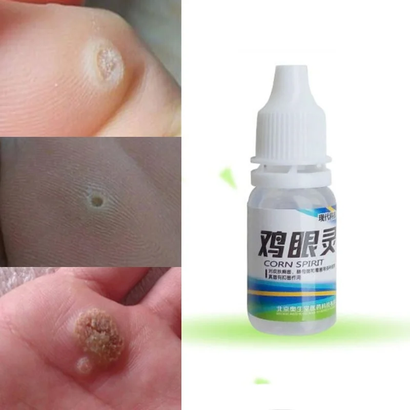 Powerful Foot Corn Remover Useful Foot Callus Remover 10ml Pro