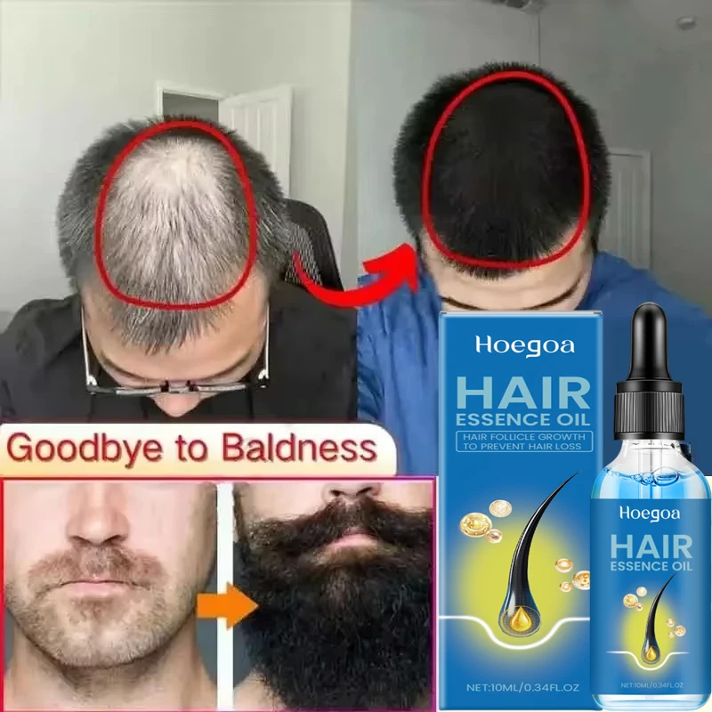 Hair Growth Serum Fast Growing Hair Care Set Essential Oil Dense Regrowth Hair Promoting Regeneration for Women Men Product