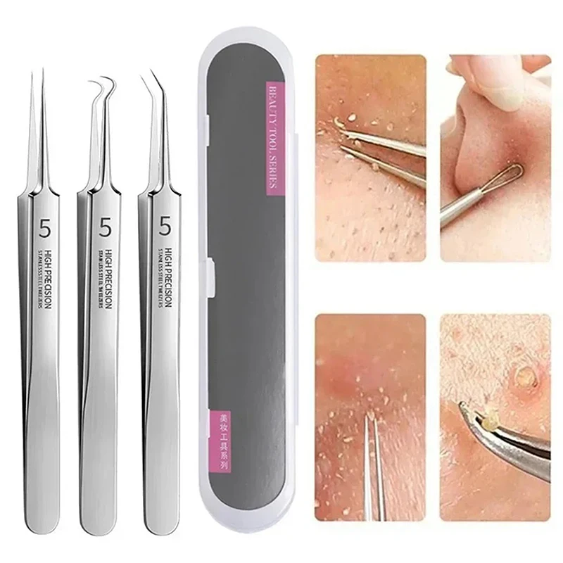 3pcs สิว Blackhead Removal Professional ULTRA-Fine แหนบ Beauty Salon สิวเข็มลึกทําความสะอาดคลิป Face Skin Care TOOL