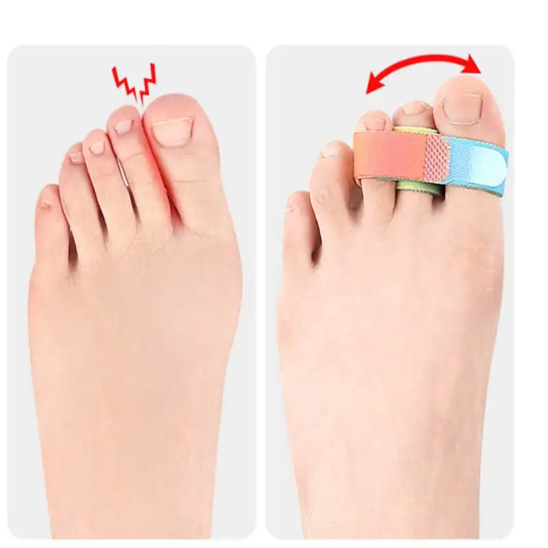 1/10/50Pcs Fingers Straightener Hammer Toe Straightener Broken Wraps Toe Splints Bandages for Crooked Curled Bent and Hammer Toe