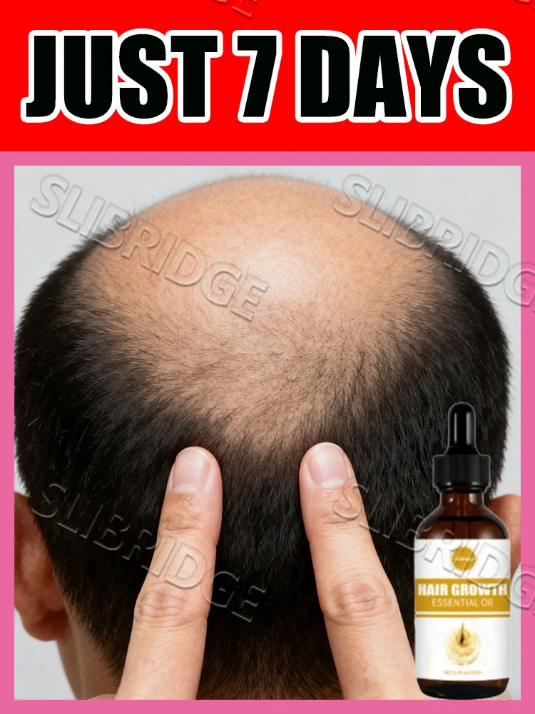 2025 nuevo masajeador herramienta para el cuidado del cuero cabelludo masaje para el cuidado entrega gratuita a domicilio